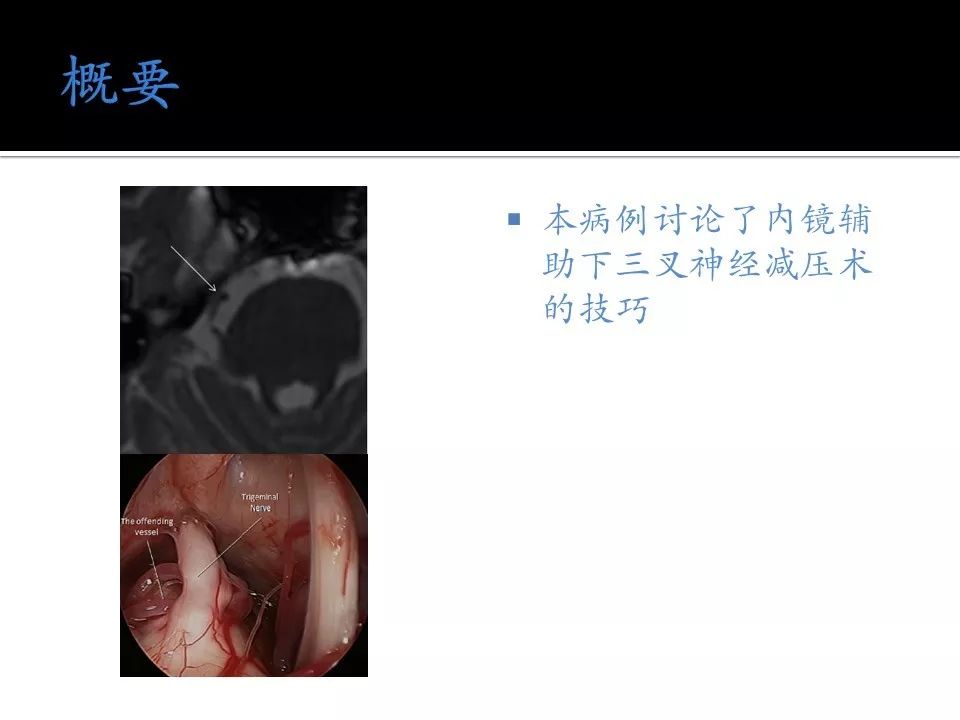 linda火影忍者 影忍能力医疗忍术出色