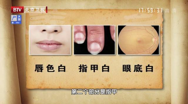 弱点免费版全集