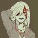 手术影片 手术影片能清晰展示手术原理